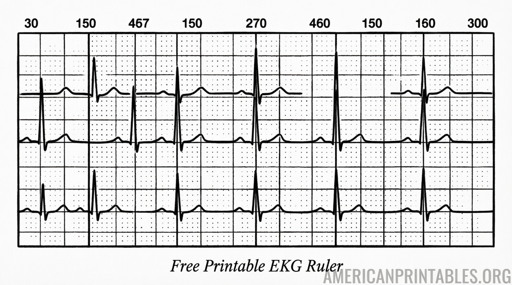 Free Printable EKG Ruler Download ECG Tool Guide (1)