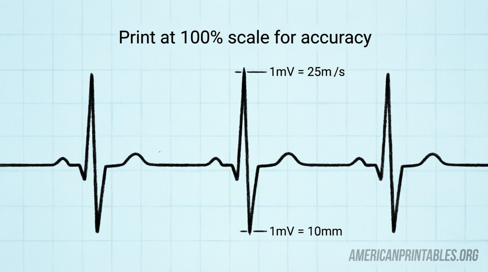 Free Printable EKG Ruler Download ECG Tool Guide (2)